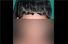 Child burnt on neck by cook at institute